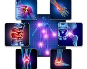 Human body joint pain concept as skeleton and muscle anatomy of the body with a group of sore joints as a painful injury or arthritis illness symbol for health care and medical symptoms with 3D illustration elements.