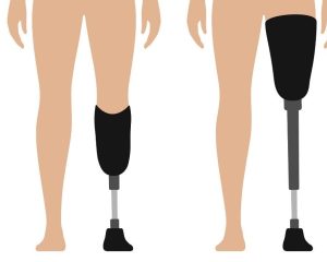 leg_prosthetics (1)